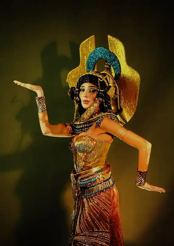 Logina Salah, la primera modelo con vitiligo en Miss Universe 2024: le contamos su historia 2 Miss-Egipto